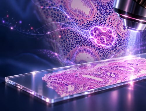 AI Spots Colorectal Cancer Metastases That Pathologists Almost Miss